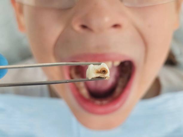 Best Tooth Pain Emergency Relief  in Gunbarrel, CO